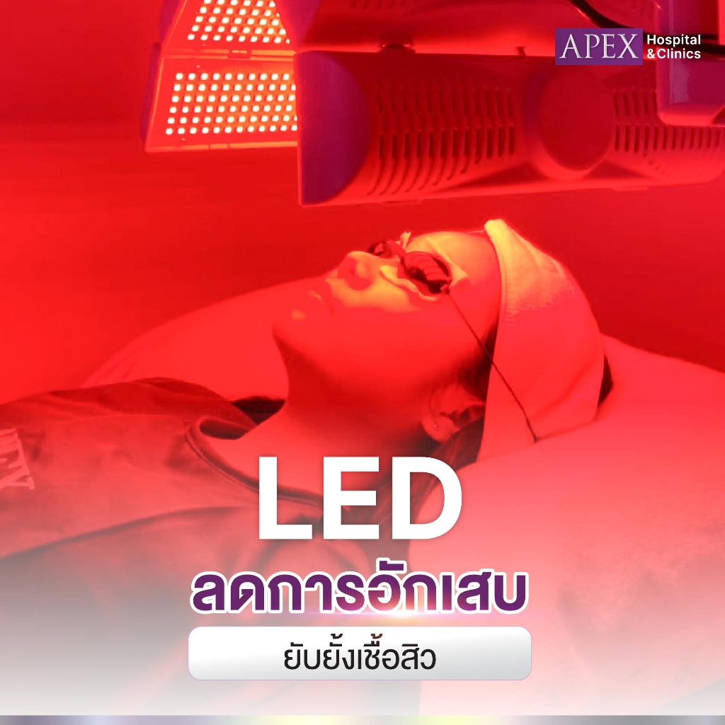[E-Voucher] APEX Acne Clear โปรแกรมเคลียร์วงจร สิว รักษาลดรอยดำ แดง จากสิว ผลัดผิว ฉายแสงฆ่าเชื้อสิว