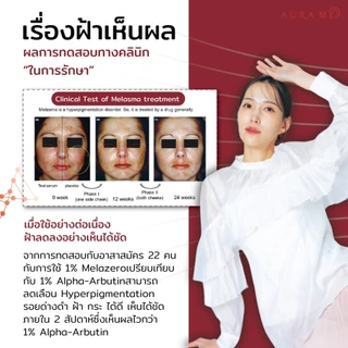 (โปร 5 ขวด) เซรั่มตัวใหม่ AURA ME ANTI-MELASMA SERUM 17ML.ออร่ามี เซรั่มฝ้า ตัวใหม่