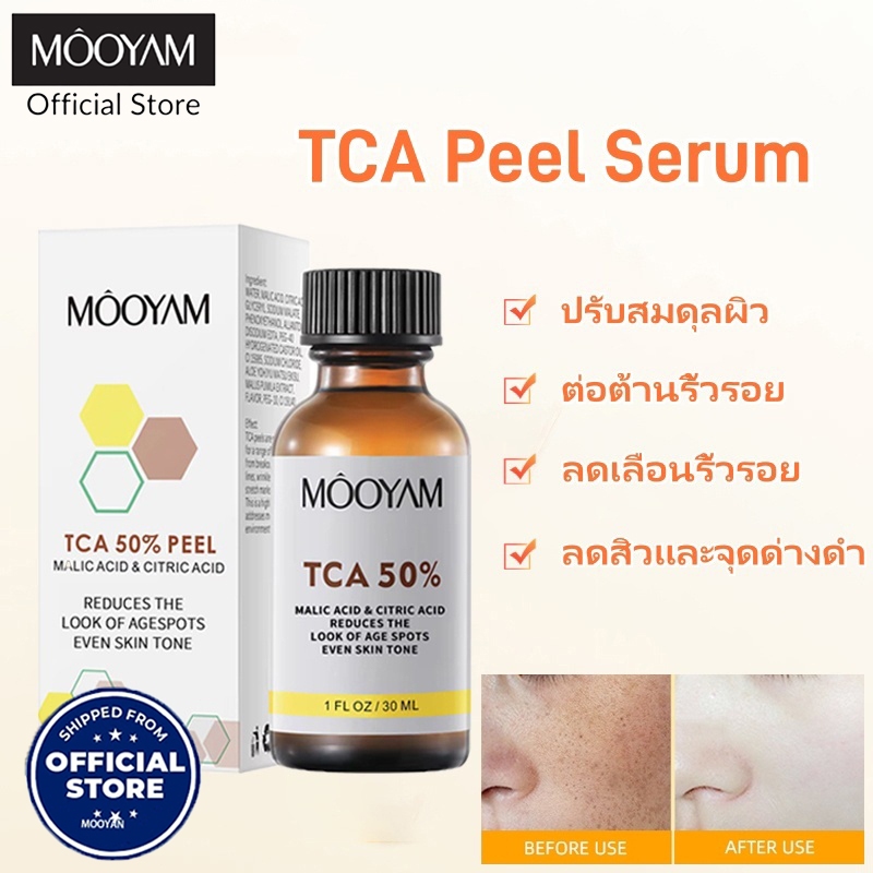 Mooyam เซรั่มปอกเปลือก 50% สารละลายกรดซิตริกสำหรับผิวหน้าผลิตภัณฑ์ดูแลผิวหน้า TCA Peel Serum 30ml