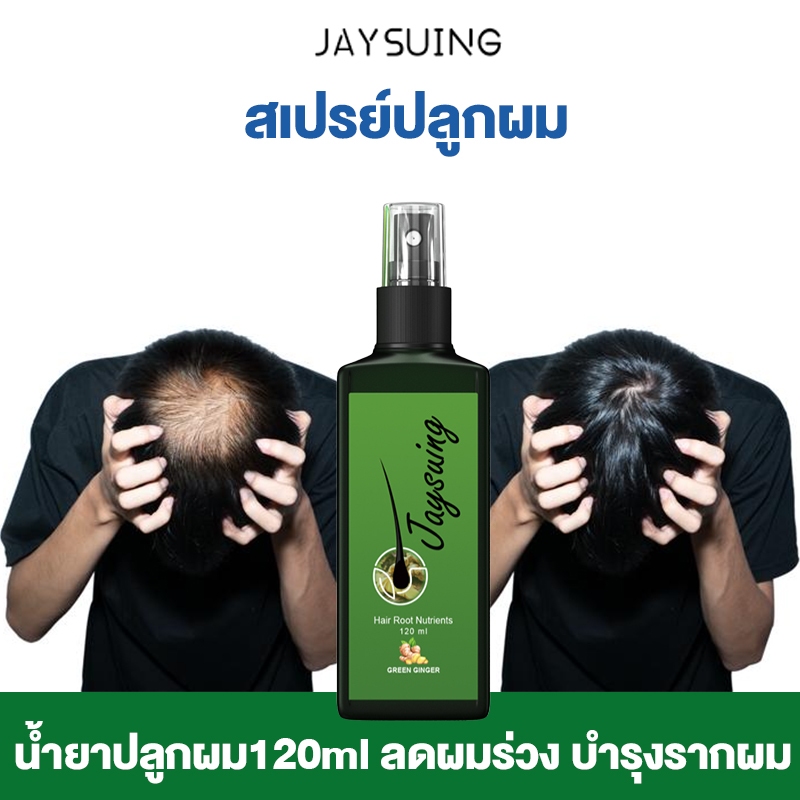 เซรั่มปลูกผม 120ml น้ำยาปลูกผมดก น้ำยาเร่งผมยาว ยาปลูกผมของแท้ น้ำยาปลูกผมผู้ชาย ป้องกันผมร่วง ทำให้รากผมแข็งแรงมากขึ้น