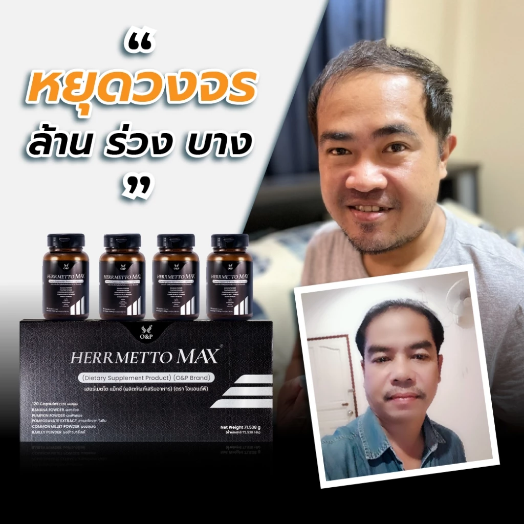 HERRMETTO Max (เฮอร์เมตโต แม็กซ์) ฟื้นฟูเส้นผม แก้ปัญหาผมร่วงหนักให้ดกหนา แข็งแรง ขนาด 120 แคปซูล