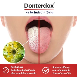 [แถมกล่องเก็บพกพา] Donterdox - ที่ขูดลิ้นสแตนเลสทรง U-Shape แปรงทำความสะอาดลิ้น ขจัดกลิ่นปาก ทำความสะอาดอย่างทั่วถึง