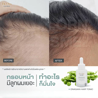 Dr.Orn Cosmez Onagain Hair Tonic เซรั่มลดผมร่วง ขนาด 30 ML
