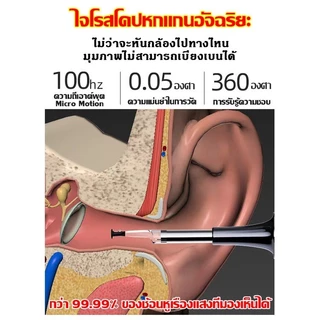 ที่ขุดหูอัจฉริยะ เชื่อมต่อบลูทูธ ดูภาพช่องหูได้ผ่านมือถือ ฟรีชุด8ชิ้น