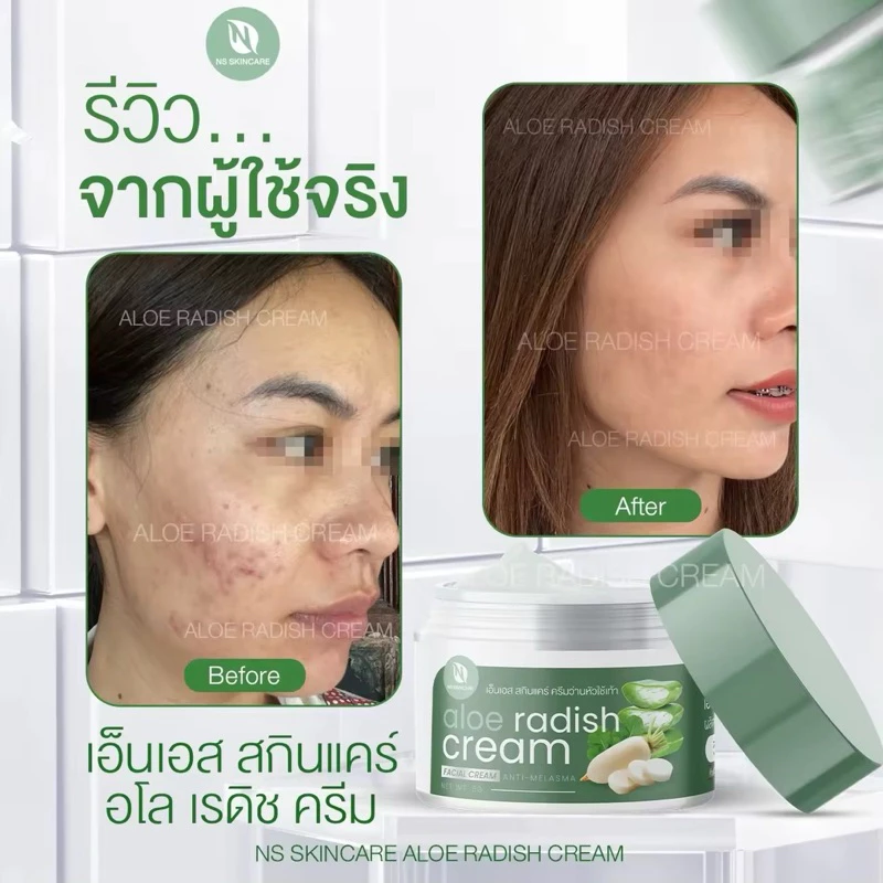 2กระปุก190ครีมว่านหัวไชเท้าบาทเอ็นเอสสกินแคร์อโลเรดิชครีม thumbnail 3