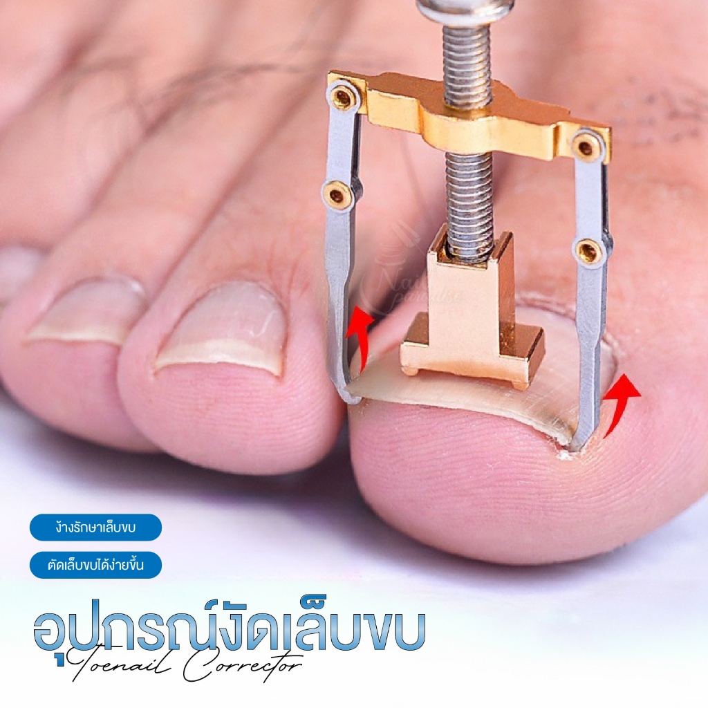 ที่งัดเล็บขบ อุปกรณ์งัดเล็บขบ ตัวช่วยง้างรักษาเล็บขบ Lifter Ingrown Toenail Tool และที่แคะซอกเล็บ