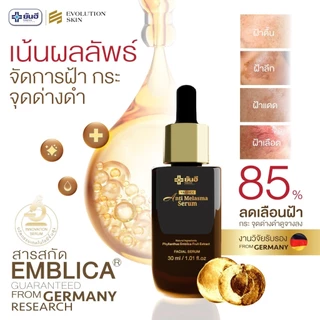 YANHEE ANTI MELASMA SERUM [ 1 ขวด ] ยันฮี แอนตี้ เมลาสม่า เซรั่มลด ฝ้า กระ ลดจุดด่างดำ แก้ฝ้า ผิวกระจ่างใส ผลัดเซลล์ผิว