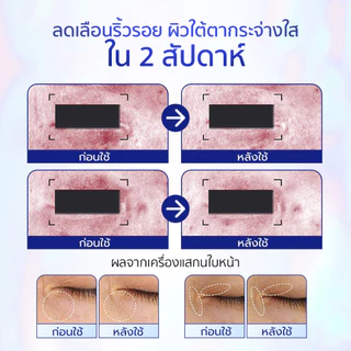 SKINTIFIC 360 Crystal Massager Lifting Eye Cream 20g มาสสาจ ลิฟติ้ง อายครีม ลดเลือนริ้วรอย ลดใต้ตาคล้ำ ไม่แสบตา