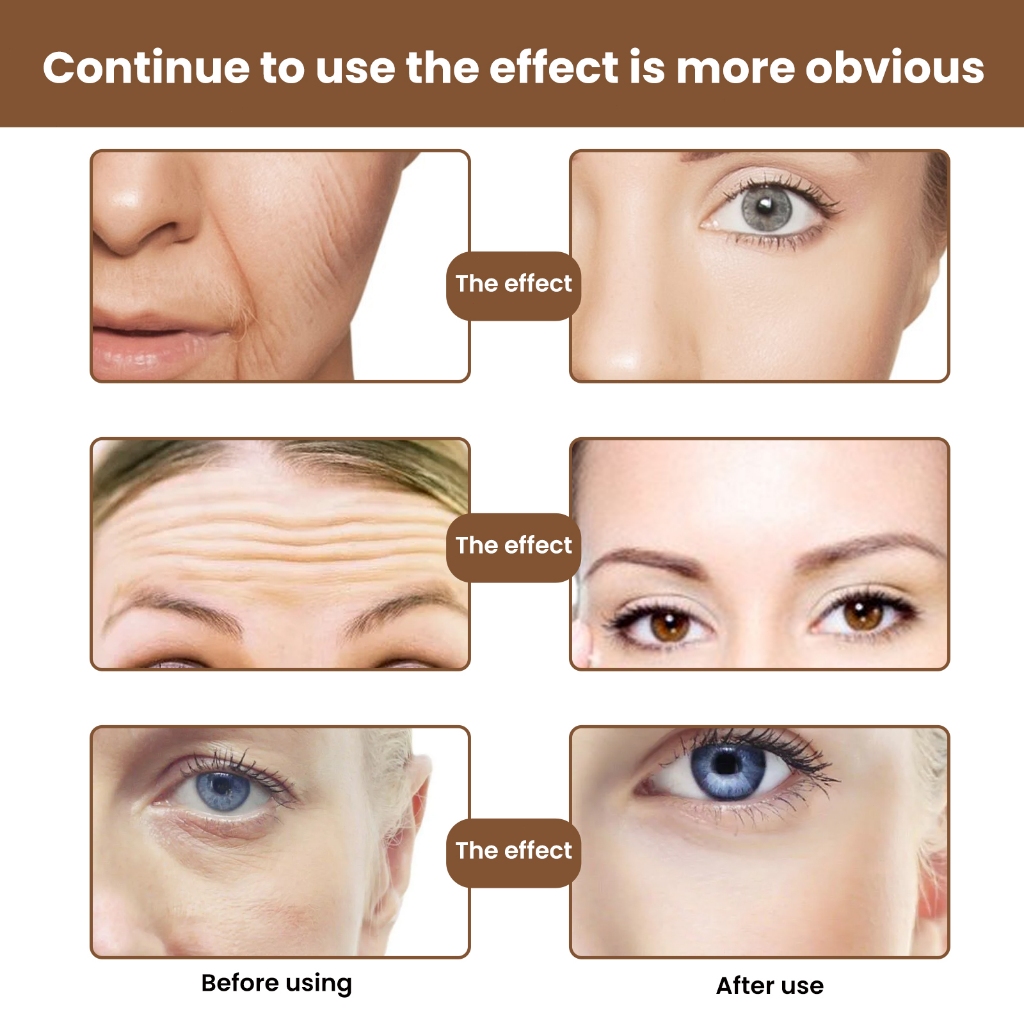 EELHOE ครีมเห็ดหลินจือ ช่วยลดเลือนริ้วรอยอย่างมีประสิทธิภาพและทำให้ครีมให้ความชุ่มชื้นเห็ดหลินจือสดใสขึ้น Reishi Cream - รูปที่ 3