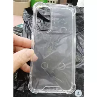 เคสใสแข็งคิงคองSamsung A27 A57 A37 A56 A36 A26 A16 A06 A55 A35 A25 A15 A54 A34 A24 A14 A05 A05S S24FE S23FE S25PlusUltra