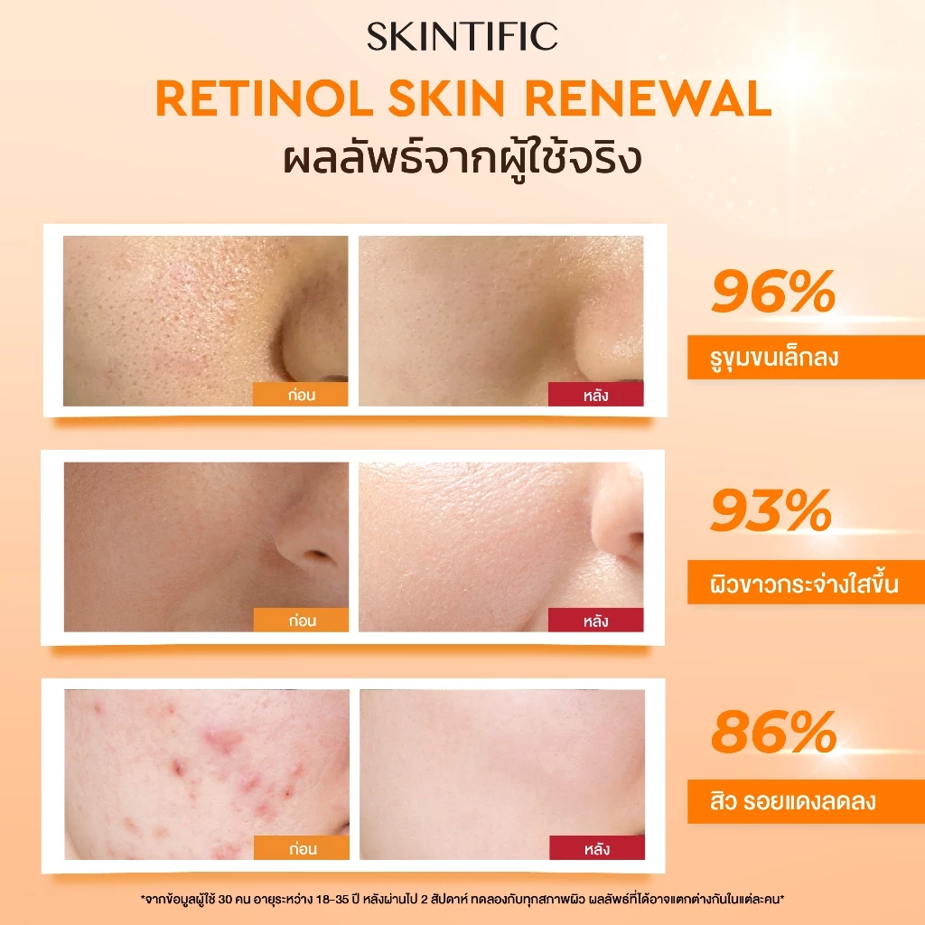 SKINTIFIC Retinol Skin Renewal Serum 20ml  สคินทิฟฟิค เรตินอล เซรั่มบำรุงผิวหน้า เรตินอล สกินแคร์  ทำให้ผิวเรียบเนียน thumbnail 8