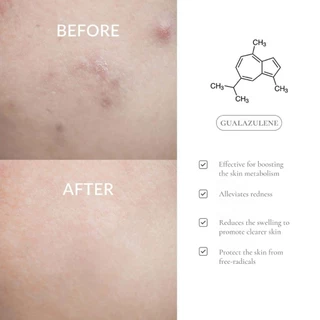 Dr.Althea 147 Barrier Cream 50 ml.ครีมบำรุงผิวหน้า ลดรอยแดง ผิวชุ่มชื้นขึ้น