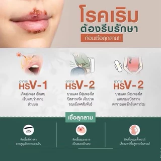 Auramed ชุดตรวจ [โรคเริม 2 สายพันธุ์] ปิดชื่อสินค้าหน้ากล่อง ติดต่อทางเพศสัมพันธ์ ผิวหนัง Herpes simplex virus (HSV 1/2)