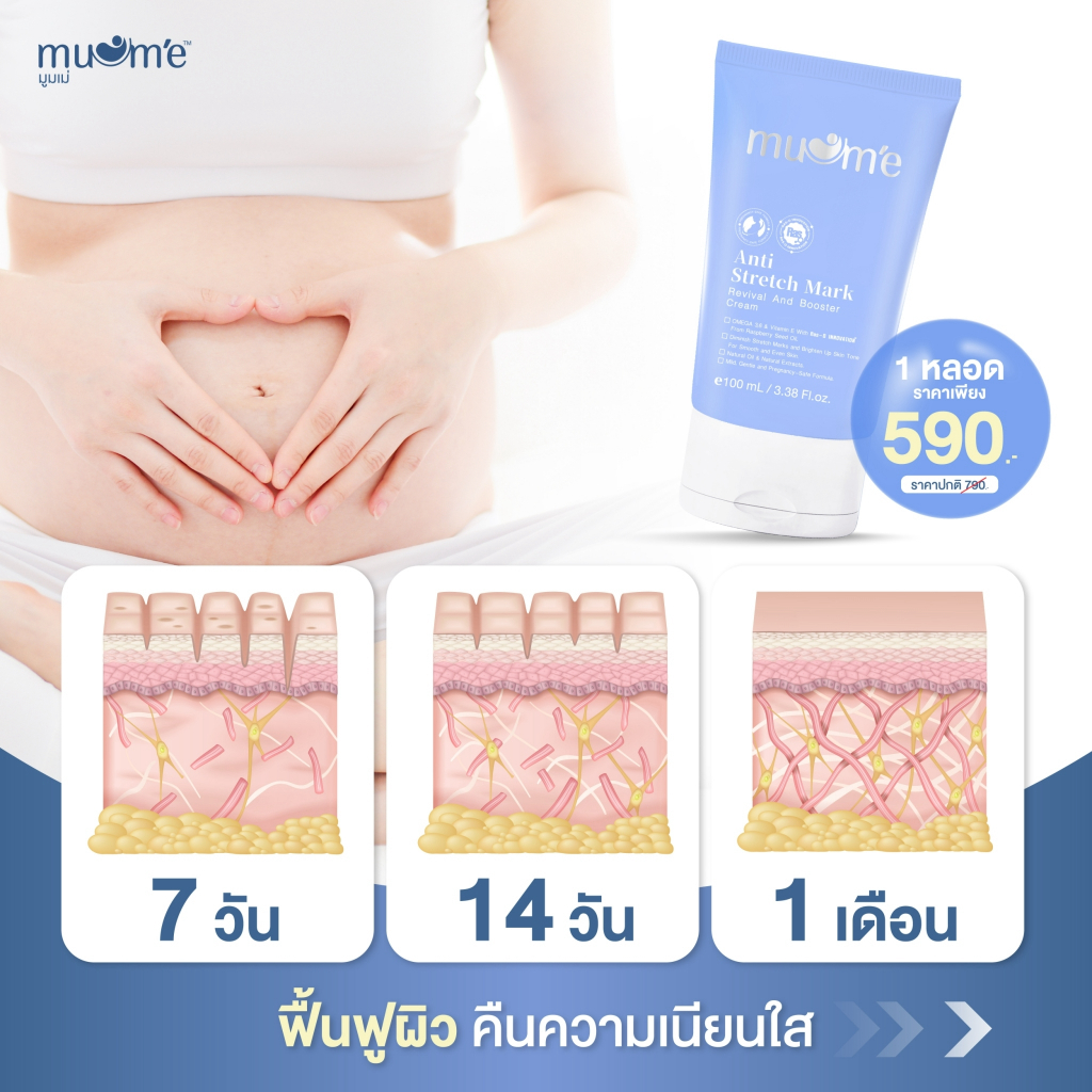 ครีมลดรอยแตก บำรุงผิวกาย Muume Anti-Stretch Mark  5 หลอด - รูปที่ 3