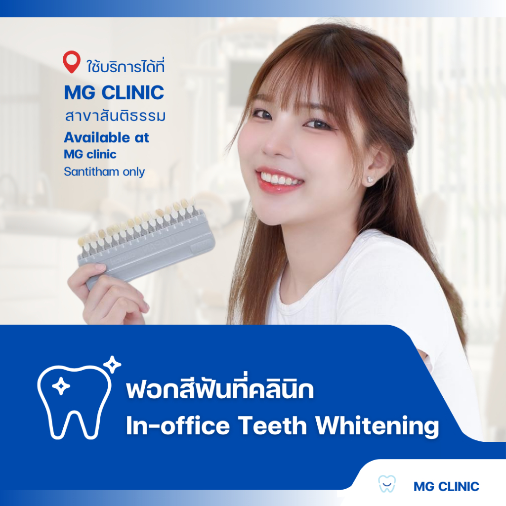 โปรแกรมฟอกสีฟันที่คลินิก (In-office Teeth Whitening) - MG Dental Clinic