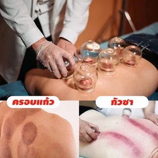 ครอบแก้วสูญญากาศ 16 ชิ้นสูท เหยือกแก้ว ครอบแก้ว สำหรับนวด การไหลเวียนโลหิต เลือดชะงักงัน ตัวแก้วหนาทนทาน