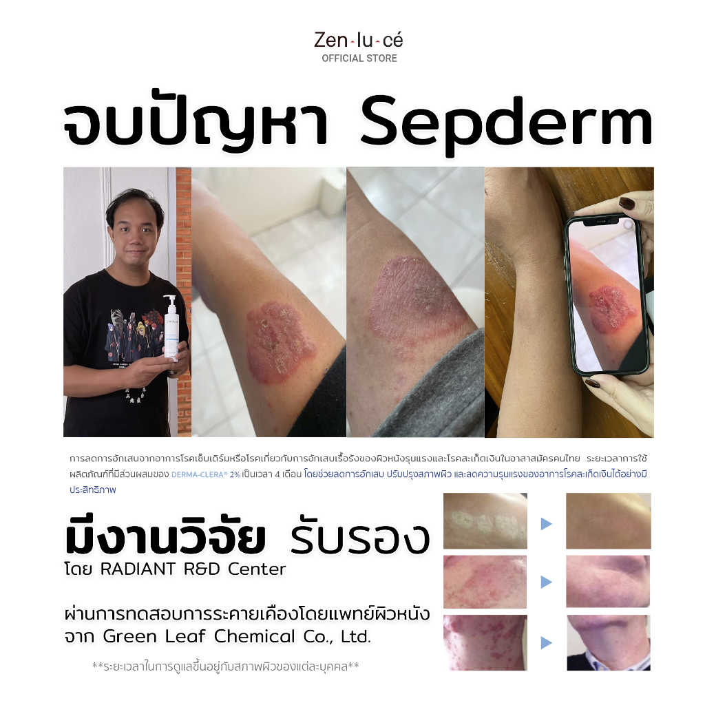 Zenluce Facial and body soothing care lotion  220 mL Premium - รูปที่ 4