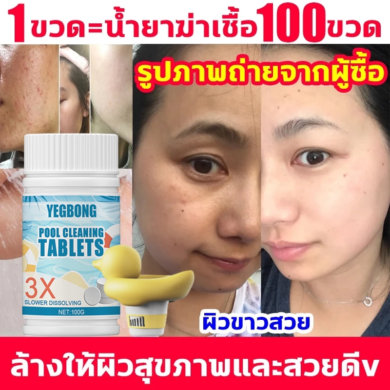 คลอรีนเม็ด ผสมน้ําอาบ อาบน้ำแล้วไม่แพ้ ผดผื่นอีกเลย ผงคลอรีน แก้แพ้น้ำคลอรีนน้ํา คลอรีนผง ไวท์เทนนิ่งผ คอรีน คลอรีนก้อน