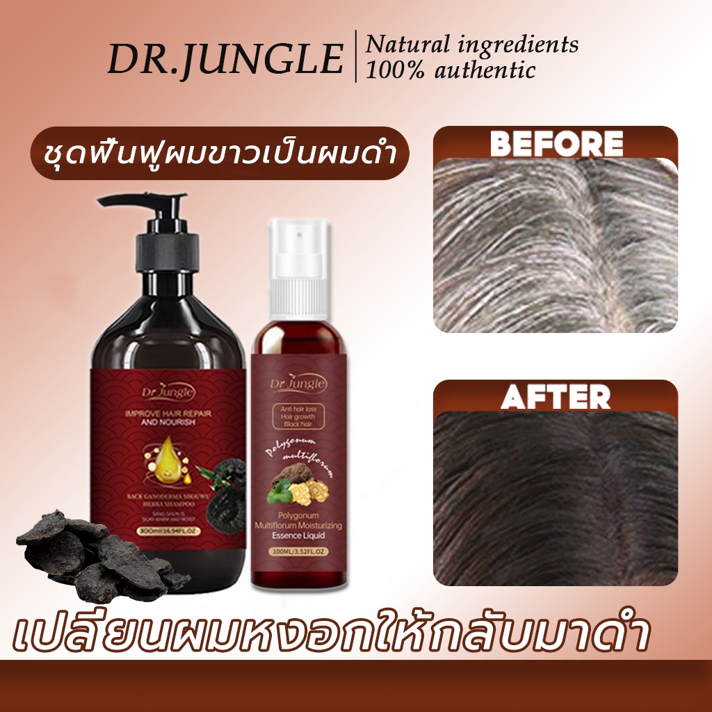 ชุดดูแลเส้นผม💦เซรั่มผมดำ แชมพูผมหงอก ลดผมหงอก สารสกัดจากพืช บำรุงราก ไม่ต้องย้อมผมแค่สระผมแล้วผมผมหงอกจะค่อยๆหายไป