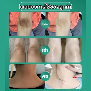 VIVX Kojic Acid ครีมขาหนีบดำ 50ml ครีมทารักแร้ขาว ครีมบำรุงรักแร้ เข่าดำ ผิวขาว สิ่งประดิษฐ์ ครีมขาหนีบดำ ครีมทาคอดำ