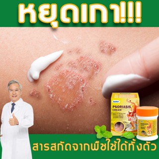 【ซื้อ 2 แถม 1】 ขี้ผึ้งทาแก้คัน โรคผิวหนัง 30 กรัม