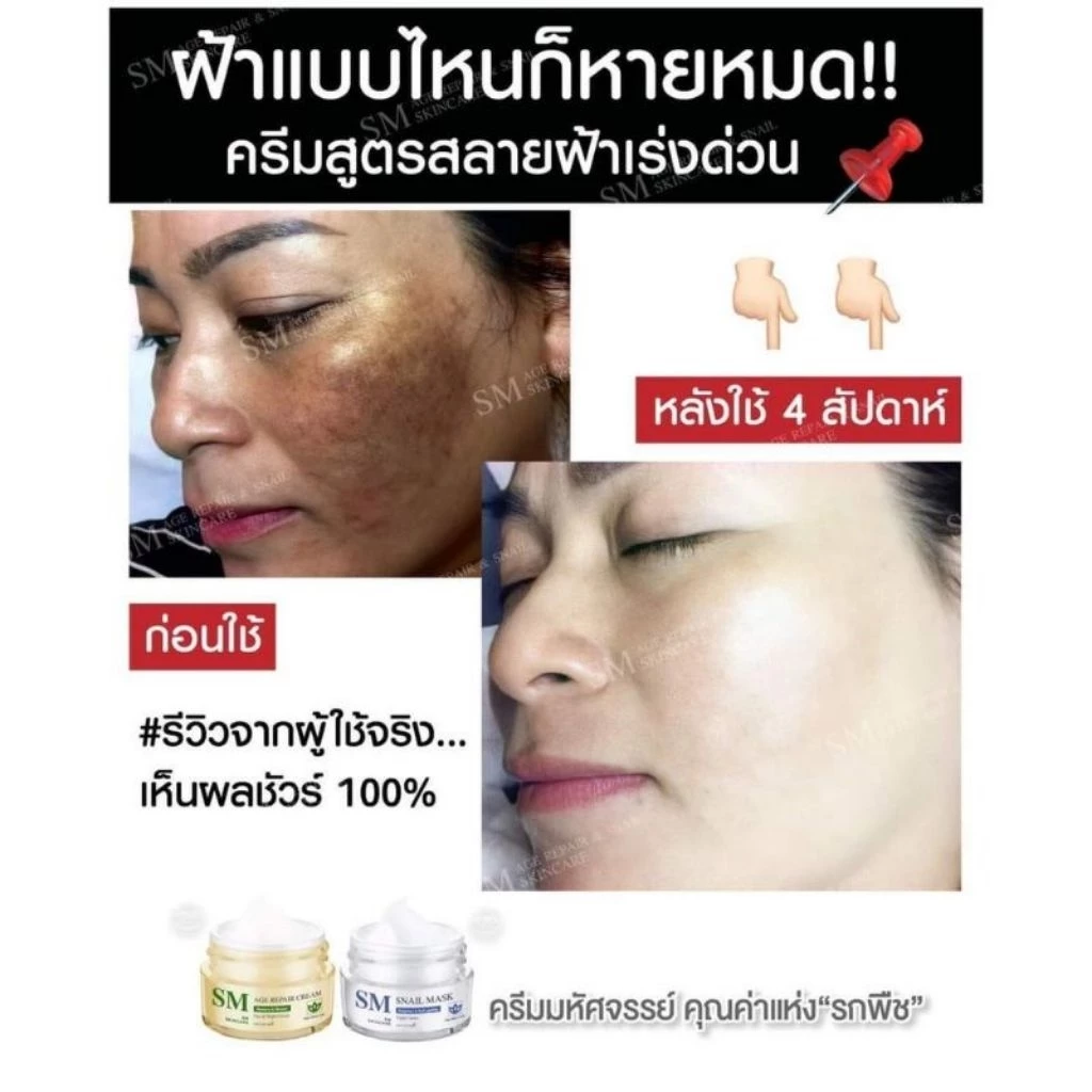 ✅ [ส่งฟรี+ส่วนลด] เซตครีมรกพืชเอสเอ็ม SM 15 g. #SM Skincare#เอสเอ็ม สกินแคร์ thumbnail 6