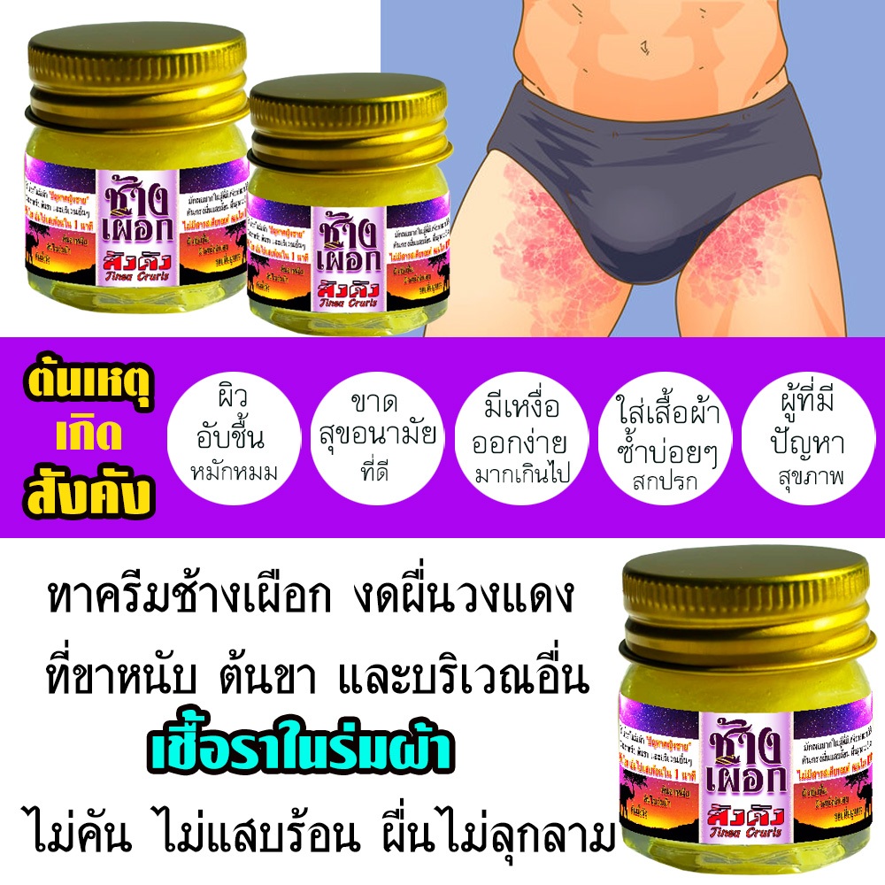 สังคังข้างขาหนีบ เชื้อราในร่มผ้า ยุบลง ลดเกา แสบ คัน ตรายยยเรียบบ