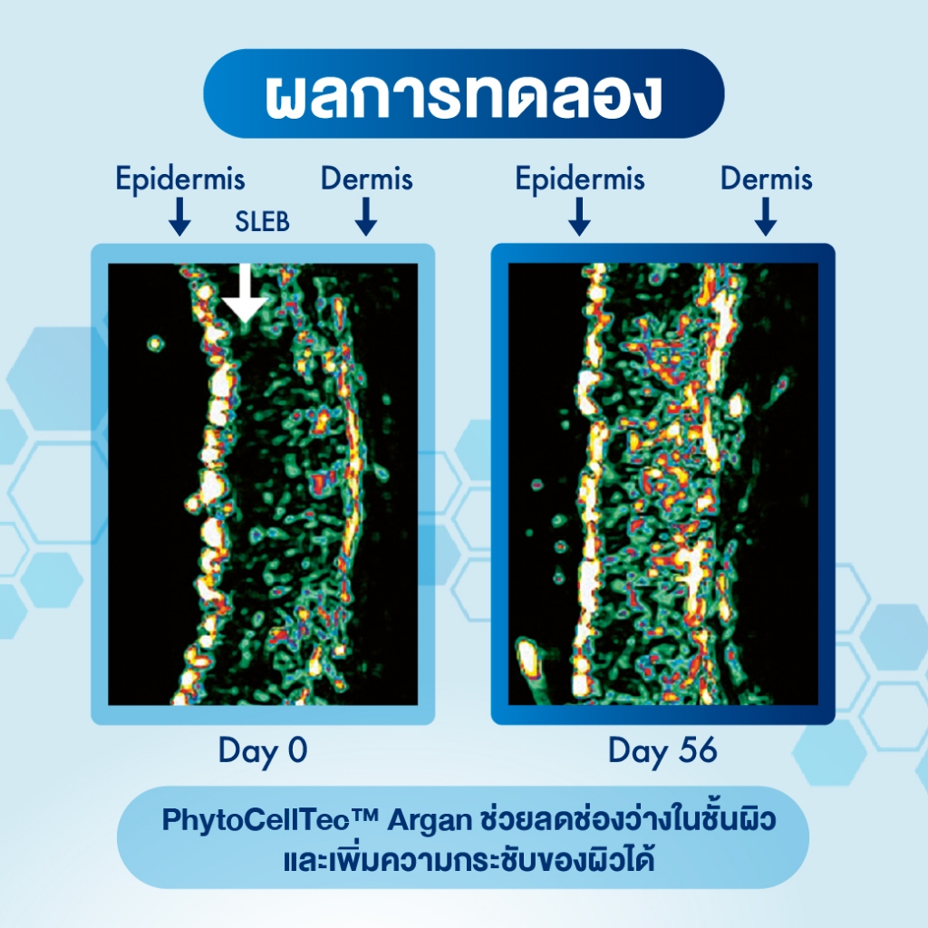 Oilatum ออยลาตุ้ม เจนเทิล เฟเชียล ซีรั่ม ผลิตภัณฑ์บำรุงผิวหน้า สูตรอ่อนโยน - รูปที่ 3