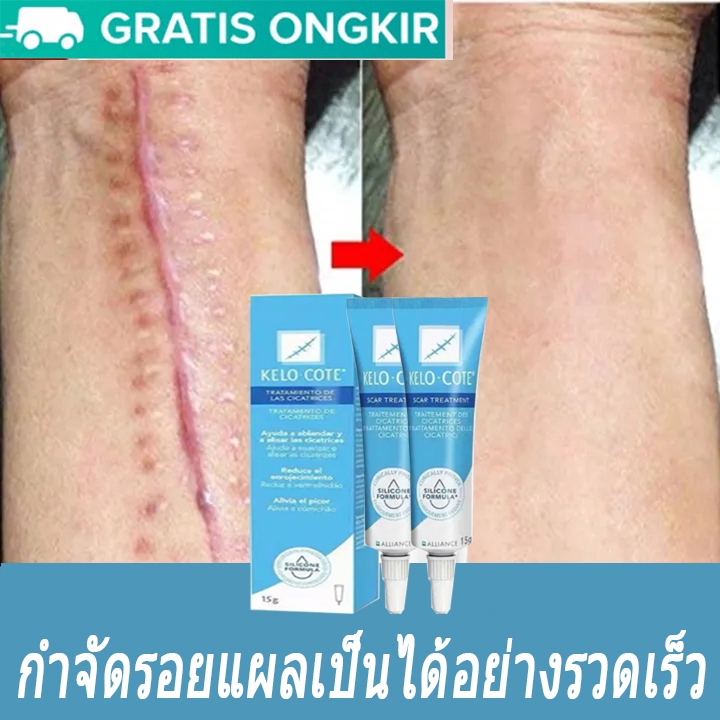 COD ของแท้ ลบรอยแผลเป็น ครีมทาแผลเป็น ครีมลดแผลเป็น scar removal cream ยาทาแผลคีลอยด์ ครีมทาแผลผ่าคลอด ลดแผลไฟไหม้ แผลน้