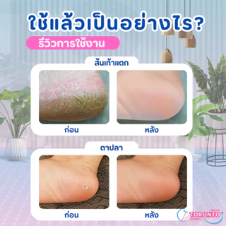 ซิลิโคนรองส้นเท้า ซิลิโคนถนอมส้นเท้า แก้ปวดส้นเท้า รองช้ำ ผิวแห้งแตก ฟรีไซส์ Silicone Heels Cover