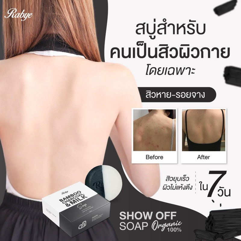 RABYE สบู่โชว์ออฟ ลดสิวผิวกาย อักเสบ อุดตัน ยับยั้งแบคทีเรีย​และการเกิดสิวซ้ำ