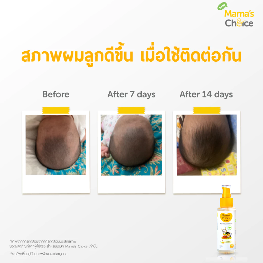 Mama's Choice โลชั่นบำรุงผม วิตามินบำรุงผมเด็ก ป้องกันหนังศีรษะแห้ง Organic ให้ผมหนา ดกดำ - Baby Hair Vitamin Lotion thumbnail 7