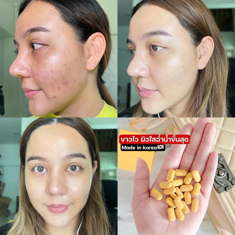 Herbitia วิตามินวัยทอง / Onepiel แอสตร้าแซนธีน / SAKANA COLLAGEN X10 Pichprove thumbnail 10