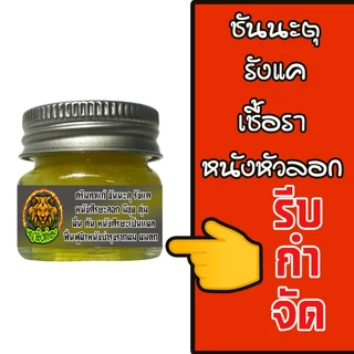 ช่วยหยุดอาการชันนะตุที่เป็นบนหัว หนังศรีษะลอก เป็นขลุย รังแค คันหัว คันหนังศรีษะ ด้วยครีมพญาสิงห์ทอง