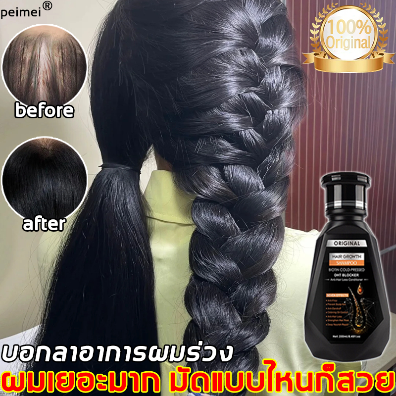 🔥ของแท้🔥peimei แชมพูสูตรขิง แชมพู แชมพูปลูกผม แชมพูเร่งผมยาว แก้ผมร่วง ป้องกันหัวล้าน สกัดจากขิงสด บำรุงรากผม  250ml