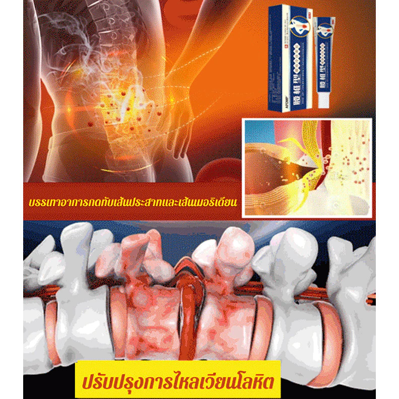 เจลร้อน (สูตรหลอดสีฟ้า) สําหรับกระดูกสันหลังส่วนเอว และโรคข้ออักเสบ สําหรับกระดูกสันหลังส่วนเอว และข้ออักเสบ - รูปที่ 5