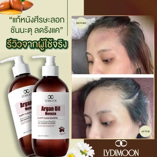 ยาสระผมขจัดรังแค แชมพูรังแค ยาสระผม 500ml ขจัดรังแค ลดคันหัว หยุดอาการคัน ลดผมร่วง แชมพูรักษาเชื้อราบนหนังศรีษะ