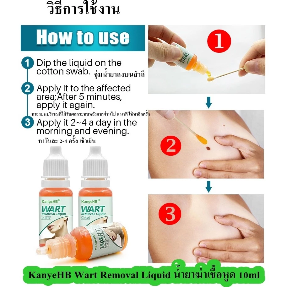น้ำยาฆ่าเชื้อหูด 10ml KanyeHB's wart-removing liquid หูดหลุดได้อย่างรวดเร็ว