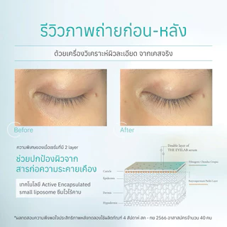 THE EYELAB BKC serum แพ็คคู่ เซรั่มแก้ใต้ตาดำจากนอนดึกและภูมิแพ้