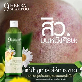 2แถม1 แชมพูโรคผิวหนัง เชื้อราบนหนังศรีษะ รังแค ลอกเป็นขลุย เชื้อรา ชันตุ กลากเกลื้อน ขุนเดช หัวลอก