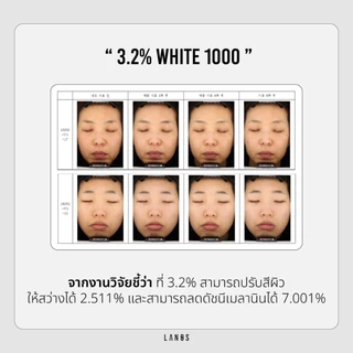 LANOS SERUM ลานอสเซรั่ม คาน่าเซรั่ม หน้าขาวใส ลดรอยสิว ฝ้ากระจางลง 20 ml.