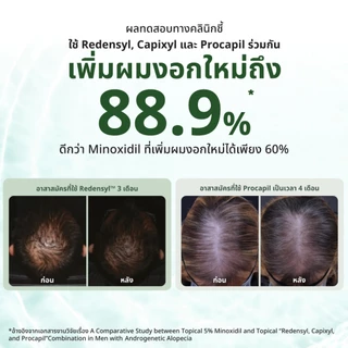 AloEx Organic Intensive Hair Serum เซรั่มบำรุงหนังศีรษะและเส้นผม สูตรเข้มข้น ลดผมร่วง ลดผมหงอก บำรุงรากผม