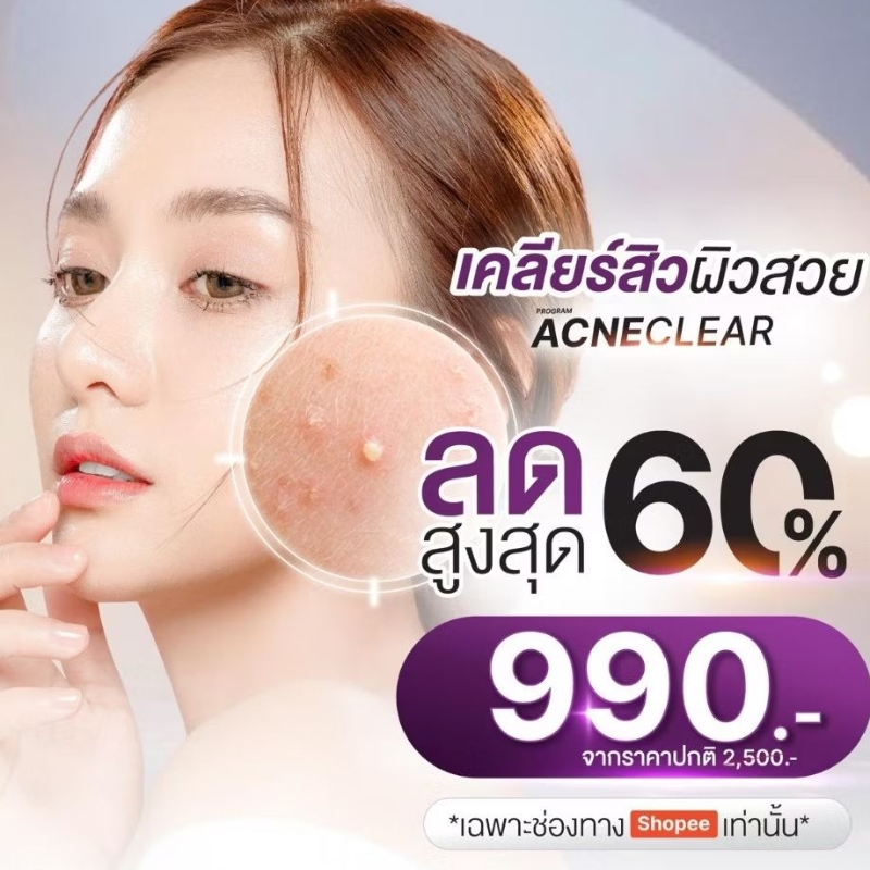 [E-Voucher] APEX Acne Clear โปรแกรมเคลียร์วงจร สิว รักษาลดรอยดำ แดง จากสิว ผลัดผิว ฉายแสงฆ่าเชื้อสิว