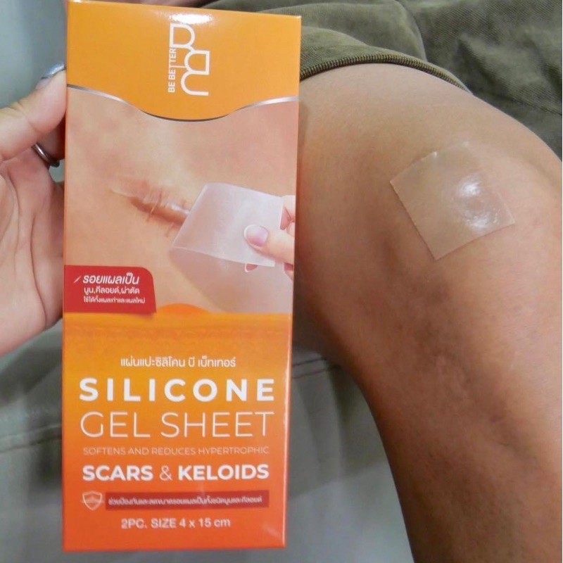 แผ่นแปะซิลิโคน Be Better Snall gel ลดรอยแผลเป็น ลดรอยนูน แผลคีลอยด์ แผลผ่าตัด คีลอยด์สิว (1ซอง บรรจุ2แผ่น) - รูปที่ 3