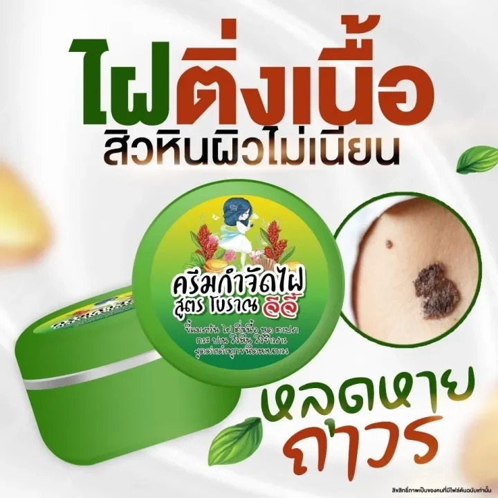 ครีมไฝจีจี้ ขี้แมลงวัน ติ่งเนื้อ หูด ตาปลา ไฝ แก้ปัญหา กระ สิวหิน ไฝ หูด จี้หูด แต้มไฝ
