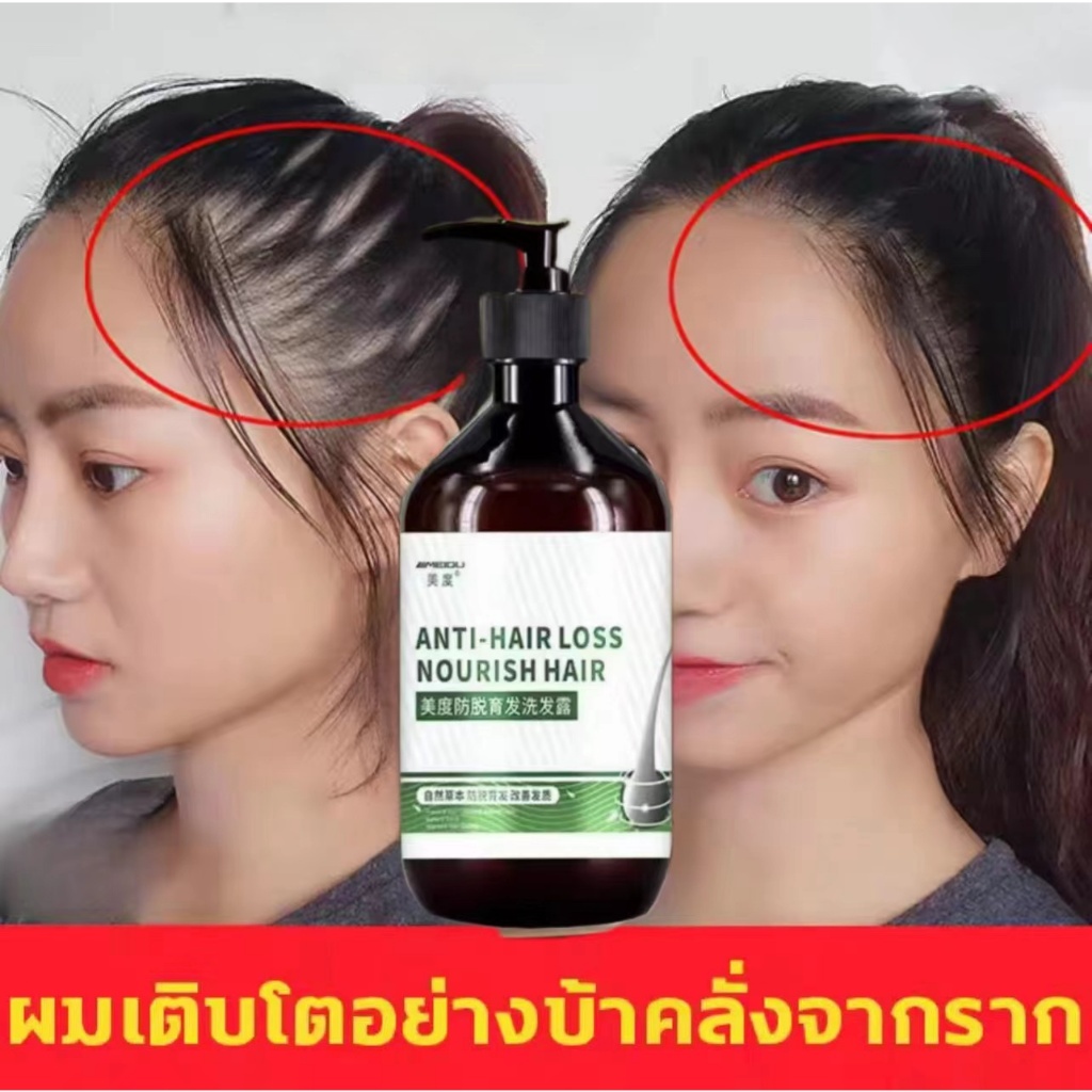 แชมพูปลูกผมดก แชมพูลดผมร่วง500ML สูตรอ่อนโยน บำรุงรูขุมผม ปรับปรุงคุณภาพเส้นผม ส่งเสริมเจริญเติบโตผม