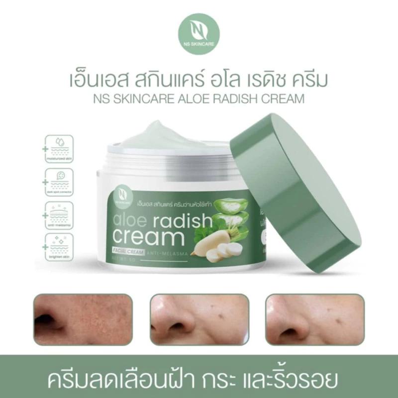 2กระปุก190ครีมว่านหัวไชเท้าบาทเอ็นเอสสกินแคร์อโลเรดิชครีม thumbnail 6