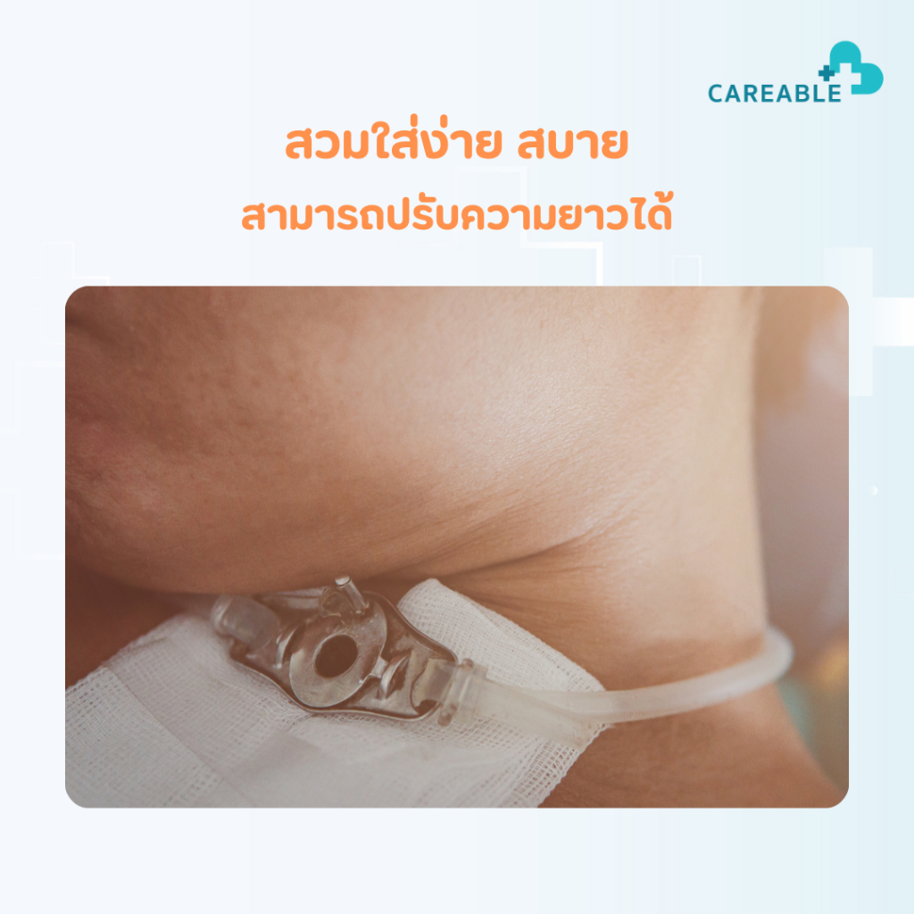 สายคล้องท่อเจาะคอ ท่อพลาสติกสามารถทำความสะอาดได้ ราคา ถูกที่สุด ดีลบีเคเค แกลเลอรีภาพที่ 3