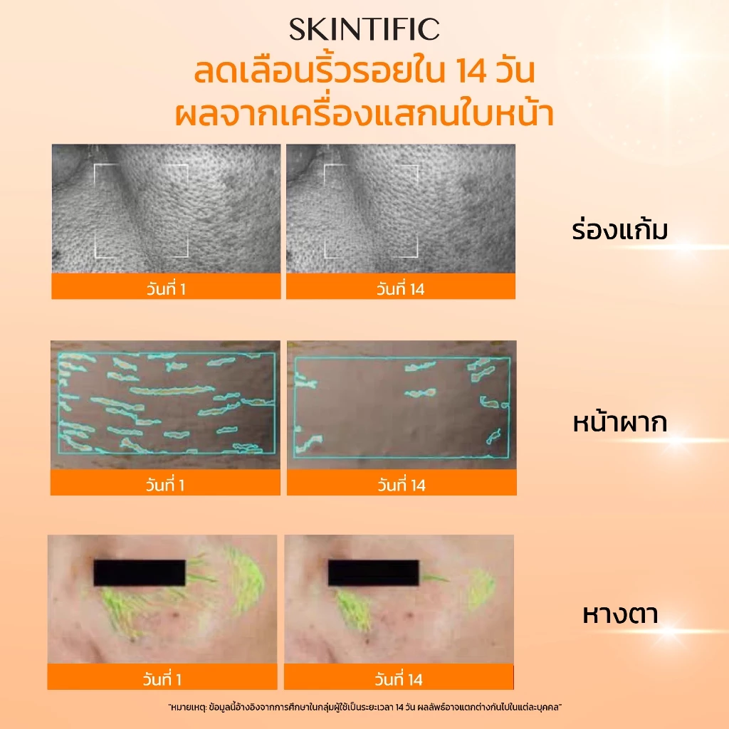 SKINTIFIC Retinol Skin Renewal Serum 20ml  สคินทิฟฟิค เรตินอล เซรั่มบำรุงผิวหน้า เรตินอล สกินแคร์  ทำให้ผิวเรียบเนียน thumbnail 7