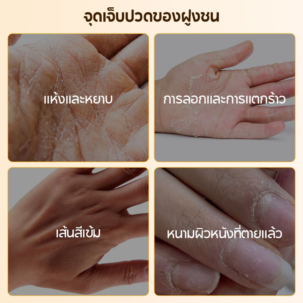 LANBENA มาส์กมือ Hand Mask ไวท์เทนนิ่ง ชุ่มชื้น ลดริ้วรอย ปกป้องมือแห้งแตก ปรับสีผิวสว่างใส  ลดริ้วรอย ให้ความชุ่มชื้น - รูปที่ 6